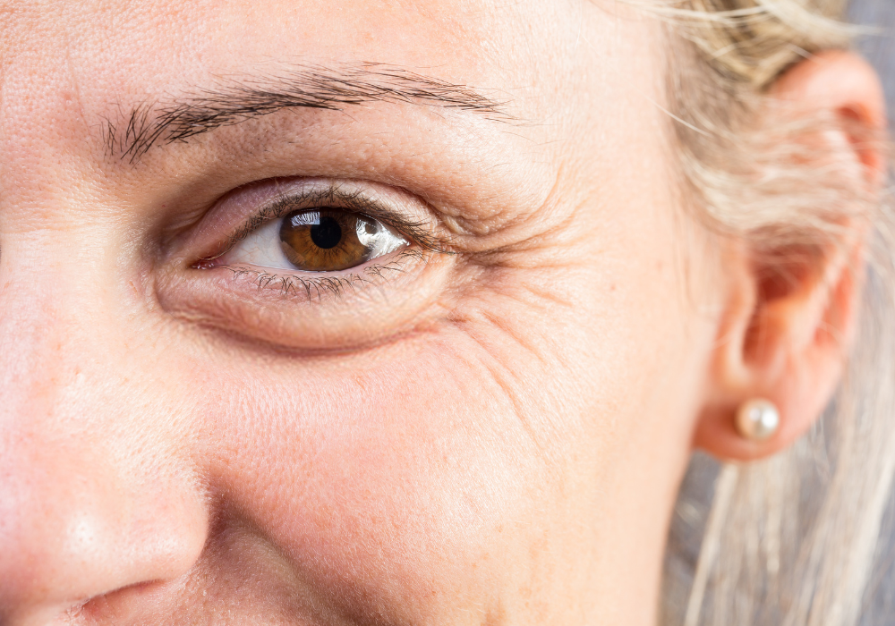 rides pattes d'oie cosmétique efficace